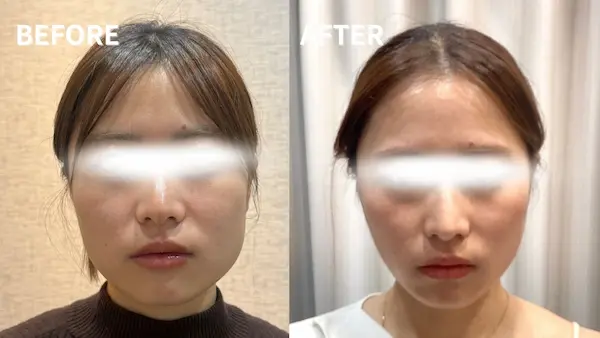 症例の画像