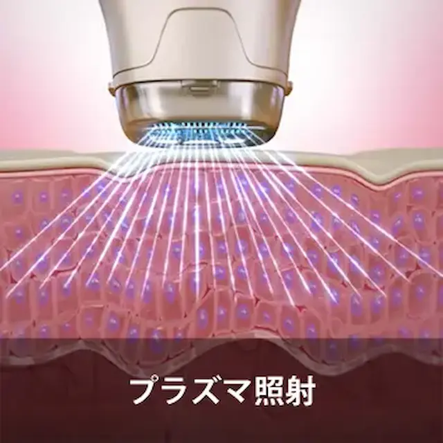 プラズマポレーション